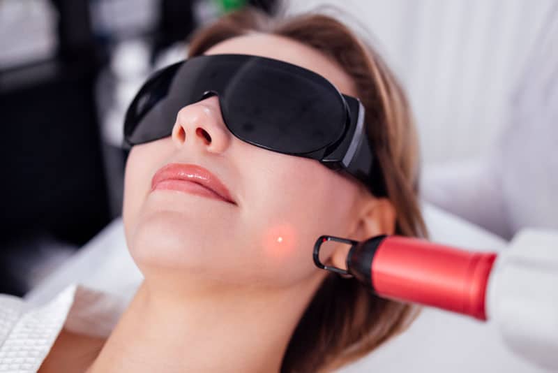 Laser comme traitements professionnels de la peau | ESI Show