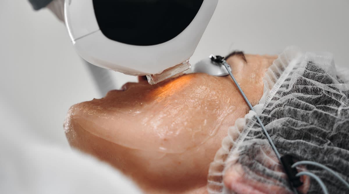 Laser treatment as Medical Esthetics & Advanced Technologies | ESI Show
