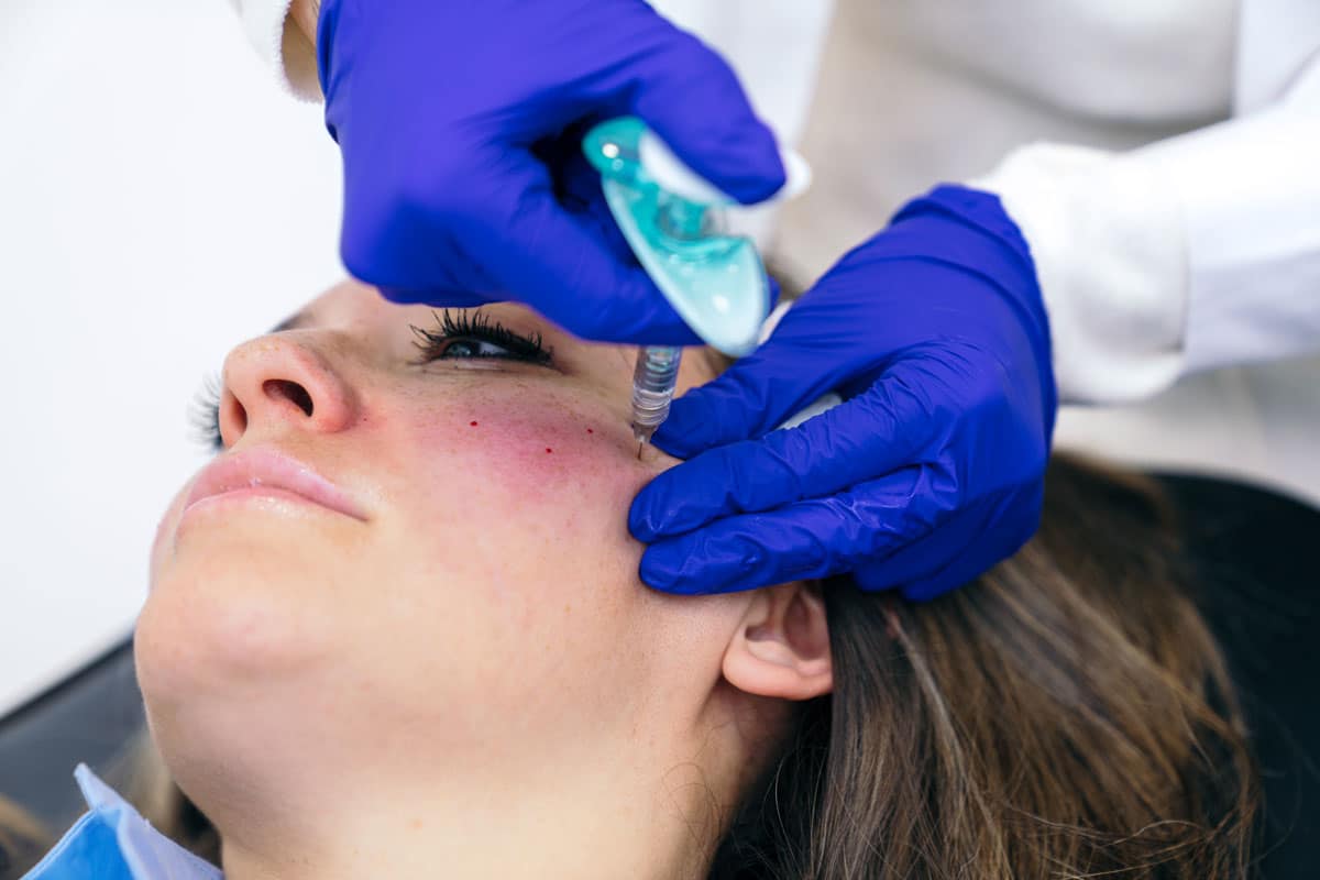 Acné, vieillissement cutané et problèmes de peau adressés avec injections acide hyaluronique | ESI show