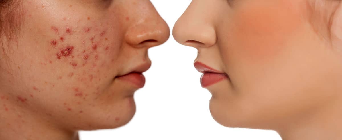 Exemples de traitements professionnels de la peau | ESI Show